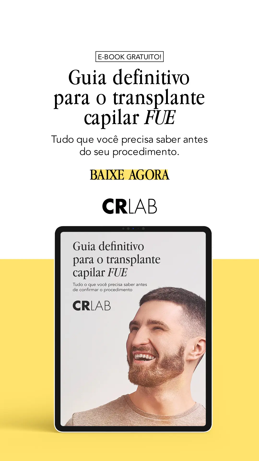 E-book gratuito! Guia definitivo para o transplante capilar FUE